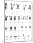 Karyotype of Chromosomes In Down's Syndrome-L. Willatt-Mounted Photographic Print