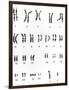 Karyotype of Chromosomes In Down's Syndrome-L. Willatt-Framed Photographic Print