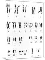 Karyotype of Chromosomes In Down's Syndrome-L. Willatt-Mounted Photographic Print