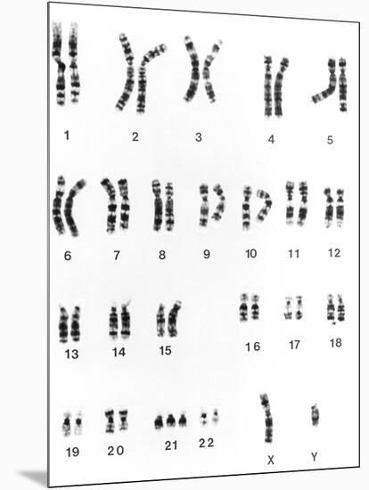 Karyotype of Chromosomes In Down's Syndrome-L. Willatt-Mounted Photographic Print