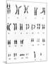 Karyotype of Chromosomes In Down's Syndrome-L. Willatt-Mounted Photographic Print