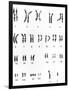 Karyotype of Chromosomes In Down's Syndrome-L. Willatt-Framed Photographic Print