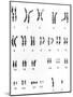 Karyotype of Chromosomes In Down's Syndrome-L. Willatt-Mounted Photographic Print