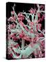 Kidney Blood Vessels, SEM-Susumu Nishinaga-Stretched Canvas