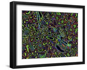 Kidney Cells, Light Micrograph-Thomas Deerinck-Framed Photographic Print