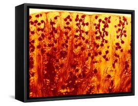 Kidney Filtering Units, Light Micrograph-Dr. Keith Wheeler-Framed Stretched Canvas