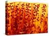 Kidney Filtering Units, Light Micrograph-Dr. Keith Wheeler-Stretched Canvas