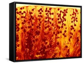 Kidney Filtering Units, Light Micrograph-Dr. Keith Wheeler-Framed Stretched Canvas