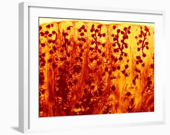 Kidney Filtering Units, Light Micrograph-Dr. Keith Wheeler-Framed Photographic Print