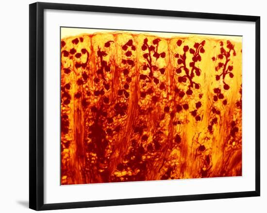 Kidney Filtering Units, Light Micrograph-Dr. Keith Wheeler-Framed Photographic Print