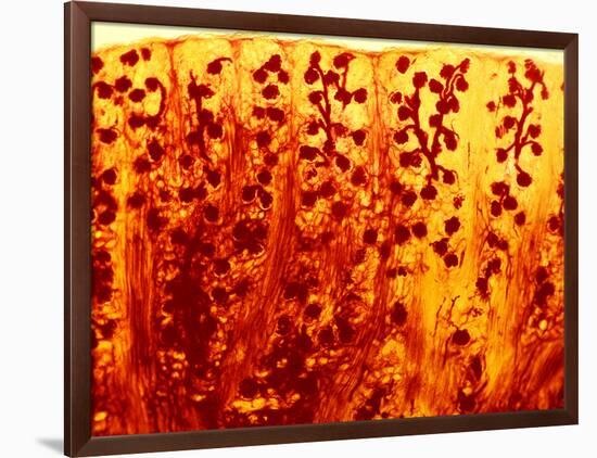 Kidney Filtering Units, Light Micrograph-Dr. Keith Wheeler-Framed Photographic Print