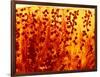 Kidney Filtering Units, Light Micrograph-Dr. Keith Wheeler-Framed Photographic Print