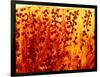 Kidney Filtering Units, Light Micrograph-Dr. Keith Wheeler-Framed Photographic Print