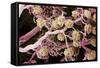Kidney Glomeruli, SEM-Steve Gschmeissner-Framed Stretched Canvas