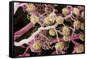 Kidney Glomeruli, SEM-Steve Gschmeissner-Framed Stretched Canvas