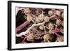 Kidney Glomeruli, SEM-Steve Gschmeissner-Framed Premium Photographic Print