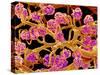 Kidney Glomeruli, SEM-Susumu Nishinaga-Stretched Canvas