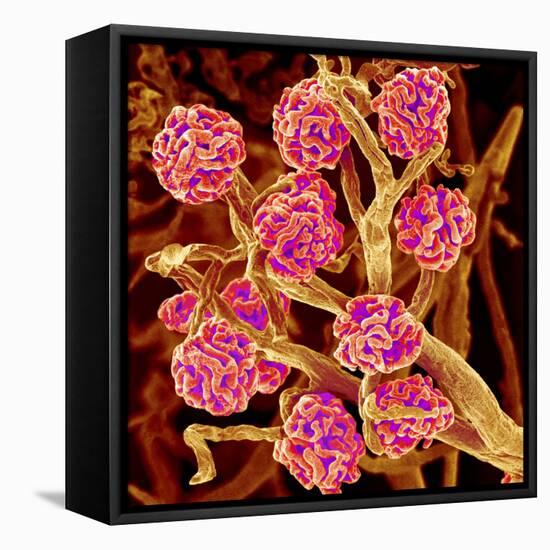 Kidney Glomeruli, SEM-Susumu Nishinaga-Framed Stretched Canvas