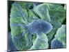 Kidney Glomeruli, SEM-Steve Gschmeissner-Mounted Photographic Print