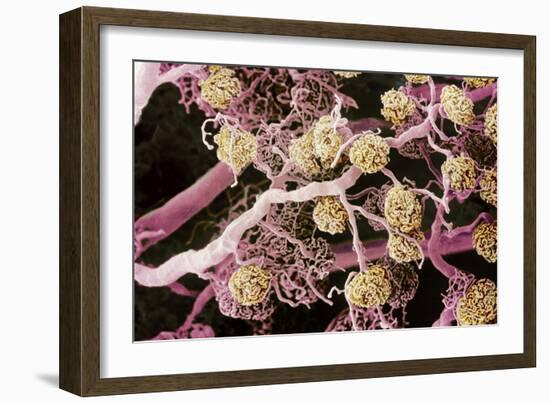 Kidney Glomeruli, SEM-Steve Gschmeissner-Framed Photographic Print