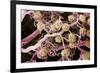 Kidney Glomeruli, SEM-Steve Gschmeissner-Framed Photographic Print