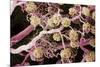 Kidney Glomeruli, SEM-Steve Gschmeissner-Mounted Photographic Print