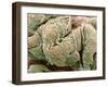 Kidney Glomeruli, SEM-Steve Gschmeissner-Framed Photographic Print