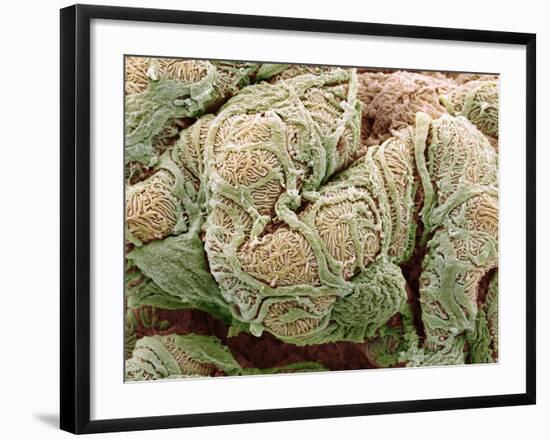 Kidney Glomeruli, SEM-Steve Gschmeissner-Framed Photographic Print