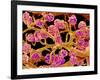 Kidney Glomeruli, SEM-Susumu Nishinaga-Framed Photographic Print