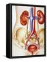 Kidney Infection-John Bavosi-Framed Stretched Canvas