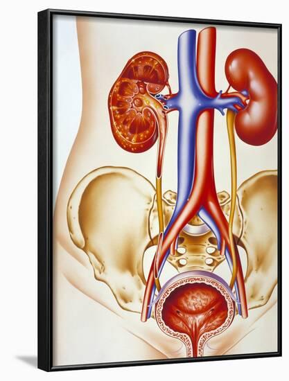 Kidney Infection-John Bavosi-Framed Photographic Print