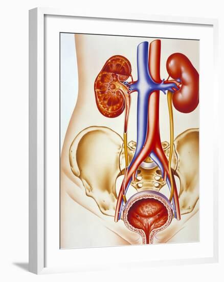 Kidney Infection-John Bavosi-Framed Photographic Print