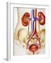 Kidney Infection-John Bavosi-Framed Photographic Print