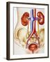 Kidney Infection-John Bavosi-Framed Photographic Print