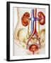 Kidney Infection-John Bavosi-Framed Photographic Print