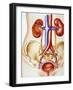 Kidney Infection-John Bavosi-Framed Photographic Print