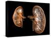 Kidneys, Artwork-PASIEKA-Stretched Canvas