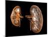 Kidneys, Artwork-PASIEKA-Mounted Photographic Print