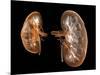 Kidneys, Artwork-PASIEKA-Mounted Photographic Print