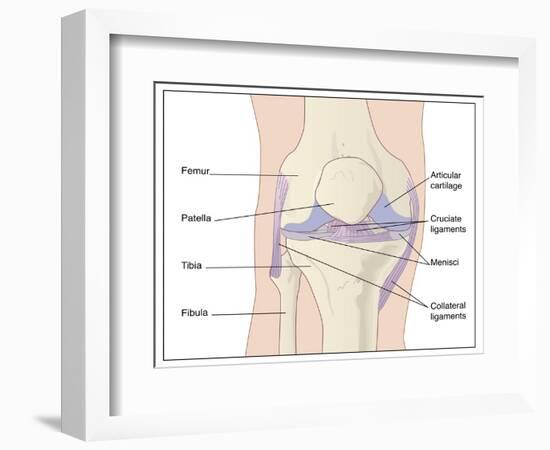 Knee Joint Anatomy, Artwork-Peter Gardiner-Framed Photographic Print