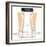 Knee Joint - Bones (Femur, Tibia, Fibula, Patella)-udaix-Framed Art Print