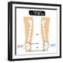 Knee Joint - Bones (Femur, Tibia, Fibula, Patella)-udaix-Framed Art Print