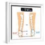 Knee Joint - Bones (Femur, Tibia, Fibula, Patella)-udaix-Framed Art Print