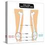 Knee Joint - Bones (Femur, Tibia, Fibula, Patella)-udaix-Stretched Canvas