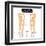 Knee Joint - Bones (Femur, Tibia, Fibula, Patella)-udaix-Framed Art Print