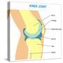 Knee Joint Cross Section-udaix-Stretched Canvas