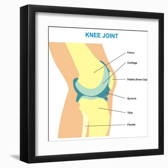 Knee Joint Cross Section-udaix-Framed Art Print