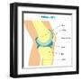 Knee Joint Cross Section-udaix-Framed Art Print