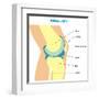 Knee Joint Cross Section-udaix-Framed Art Print