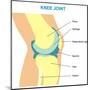 Knee Joint Cross Section-udaix-Mounted Art Print